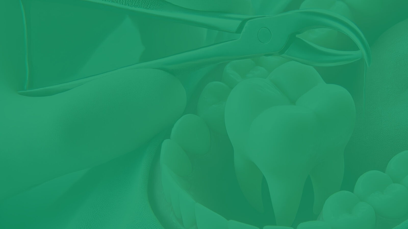 wyrywanie ósemek Lublin